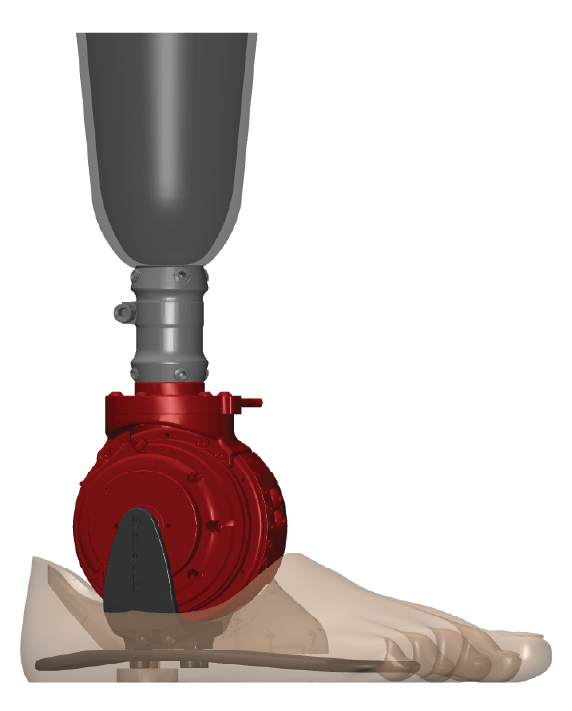 NEUankle_L1 device closeup