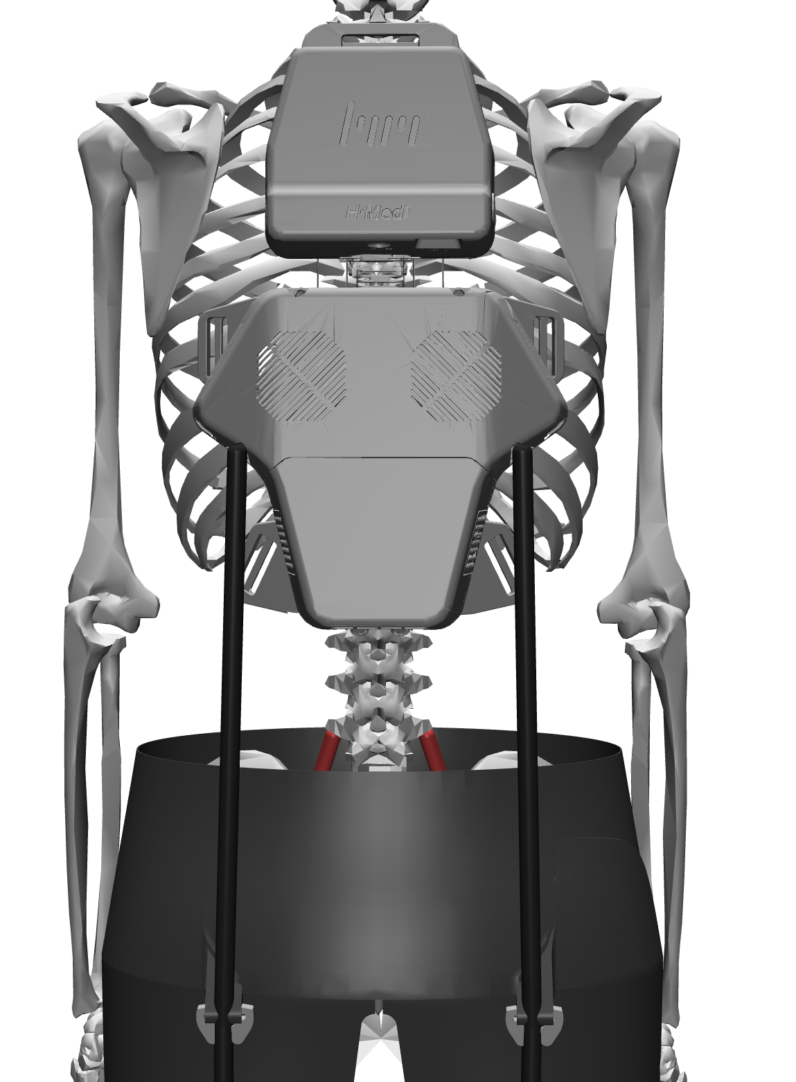 HMEDI Detail