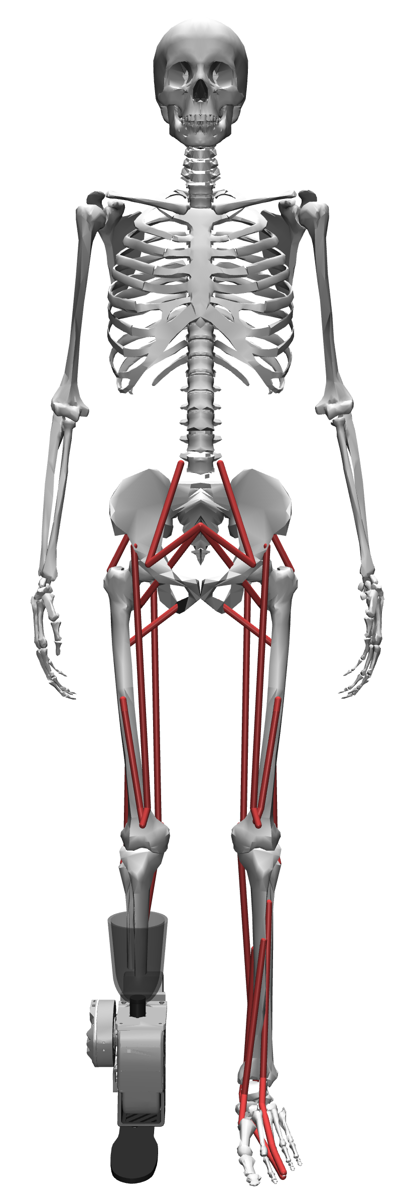 OSL Ankle Device