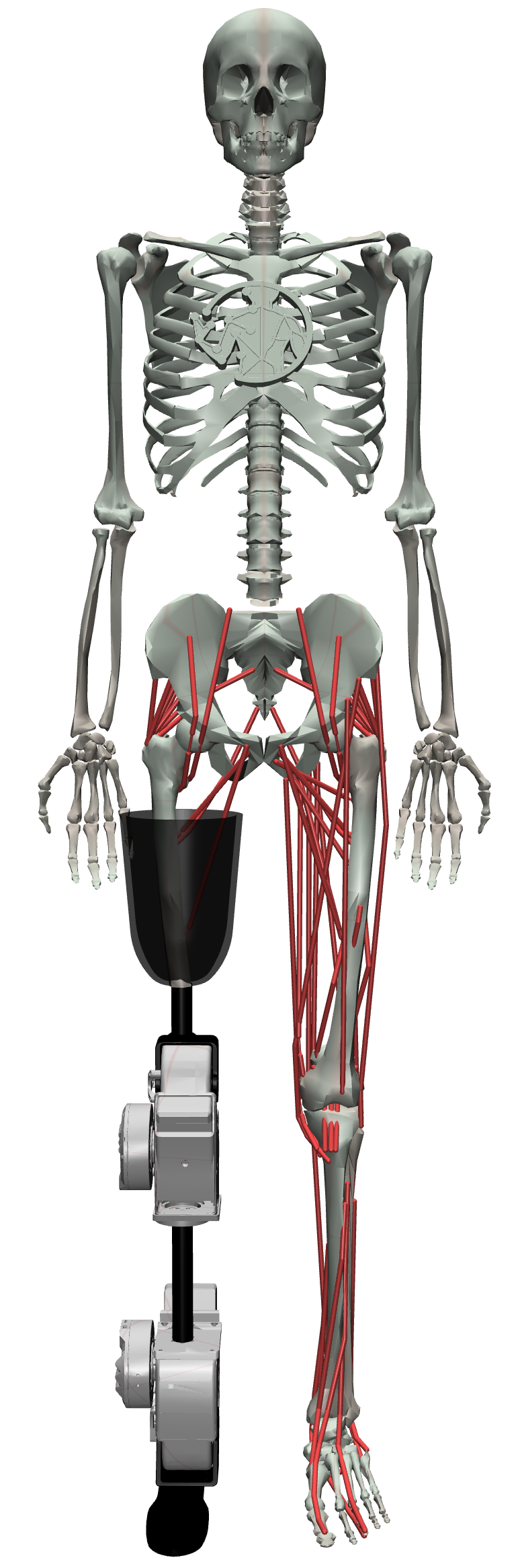 OSL Knee-Ankle Device