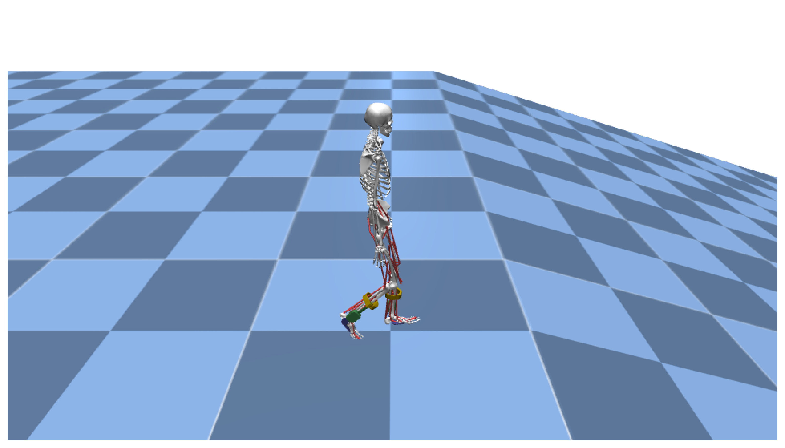 Negative slope terrain